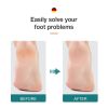 MR.GREEN Foot File Double Sided Callus Remover For Dead Skin Professional Pedicure Tools Callous Scraper Foot Sander Heel Filer
